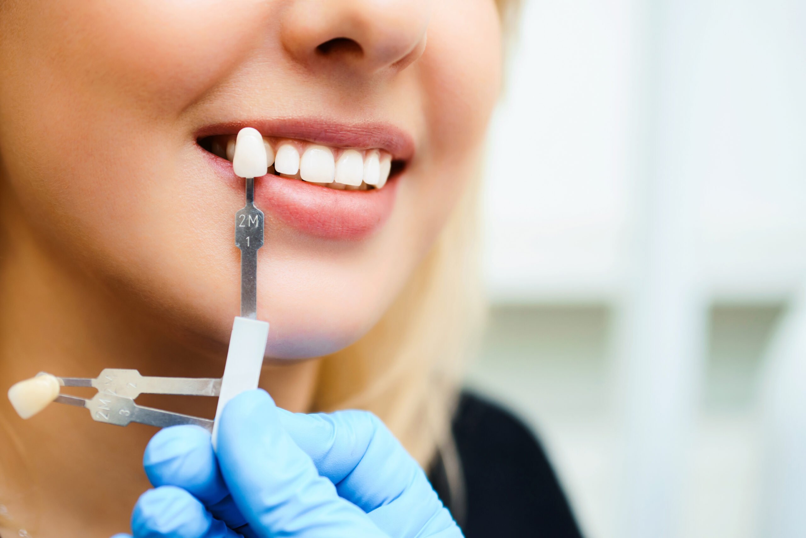 Mini Dental Implants
