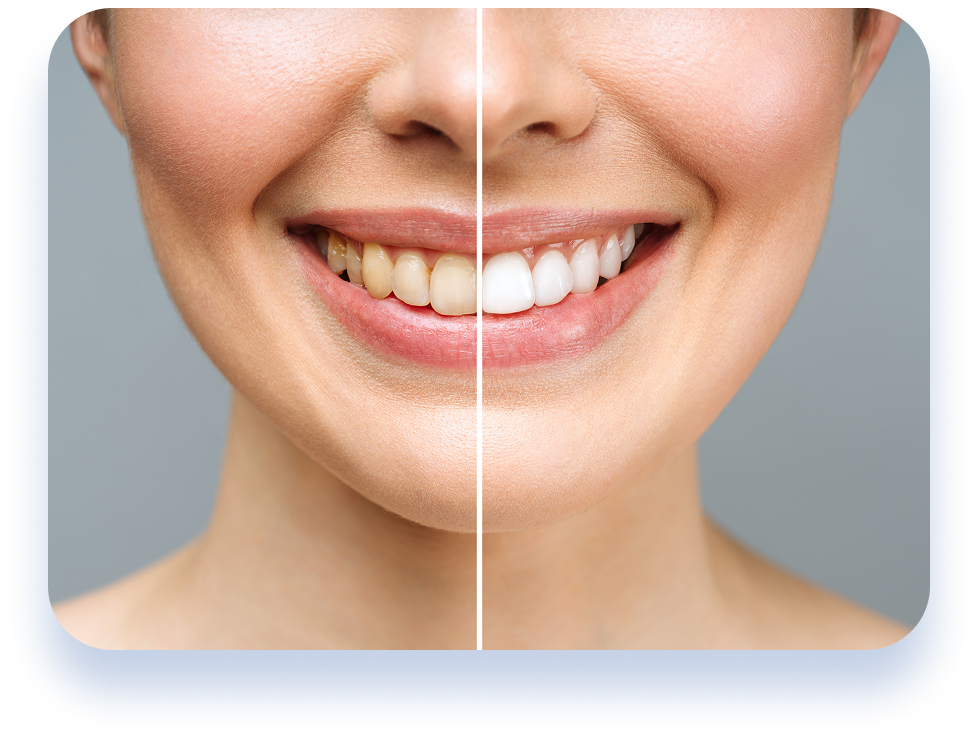 Whole mouth rehabilitation service page image