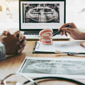 Combining Dental Implants